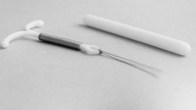 Como conseguir DIU e Implante gratuito para mulheres e adolescentes no SUS 3 diu implante